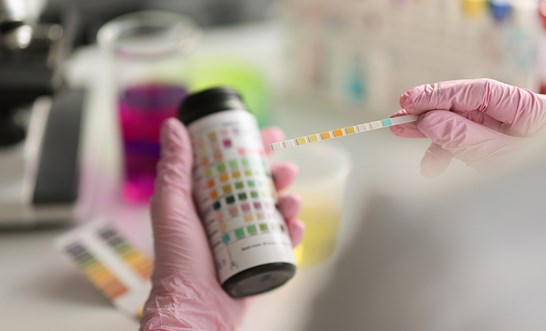 Drug and alcohol testing in the workplace: what you need to know