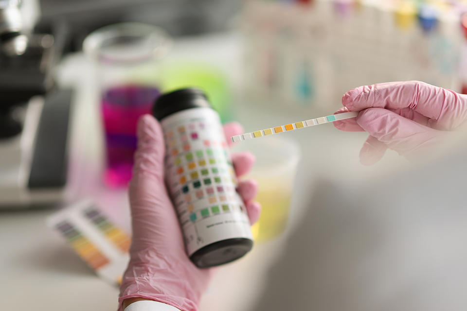 Drug and alcohol testing in the workplace: what you need to know